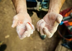 Common Types of Personal Injuries