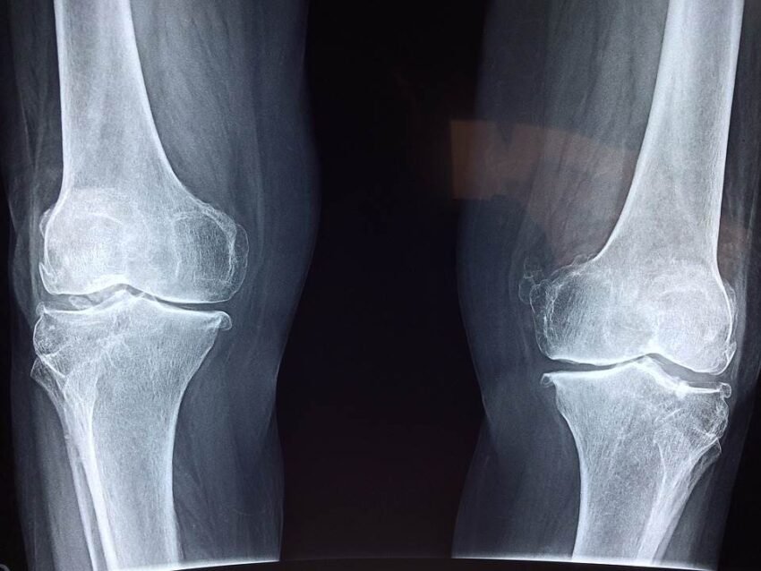 Steps to Protect Yourself After Sustaining a Personal Injury