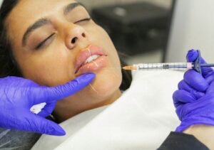 Dermal Fillers Supplier Maylips