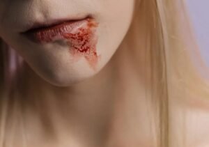 World of Personal Injury Law