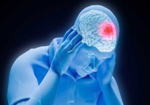 Symptoms of a Traumatic Brain Injury
