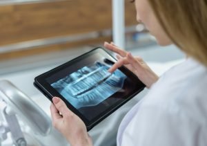 Dental Implants for Older Adults