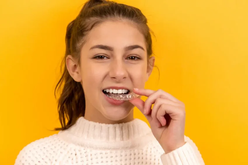 Cost of Clear Aligners