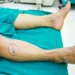 patient leg marked for surgery in hospital setting