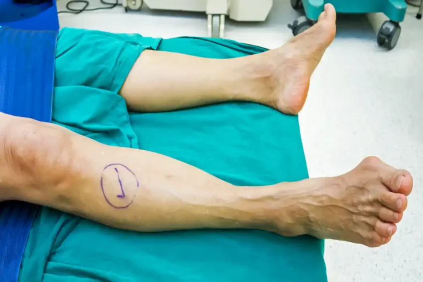 patient leg marked for surgery in hospital setting