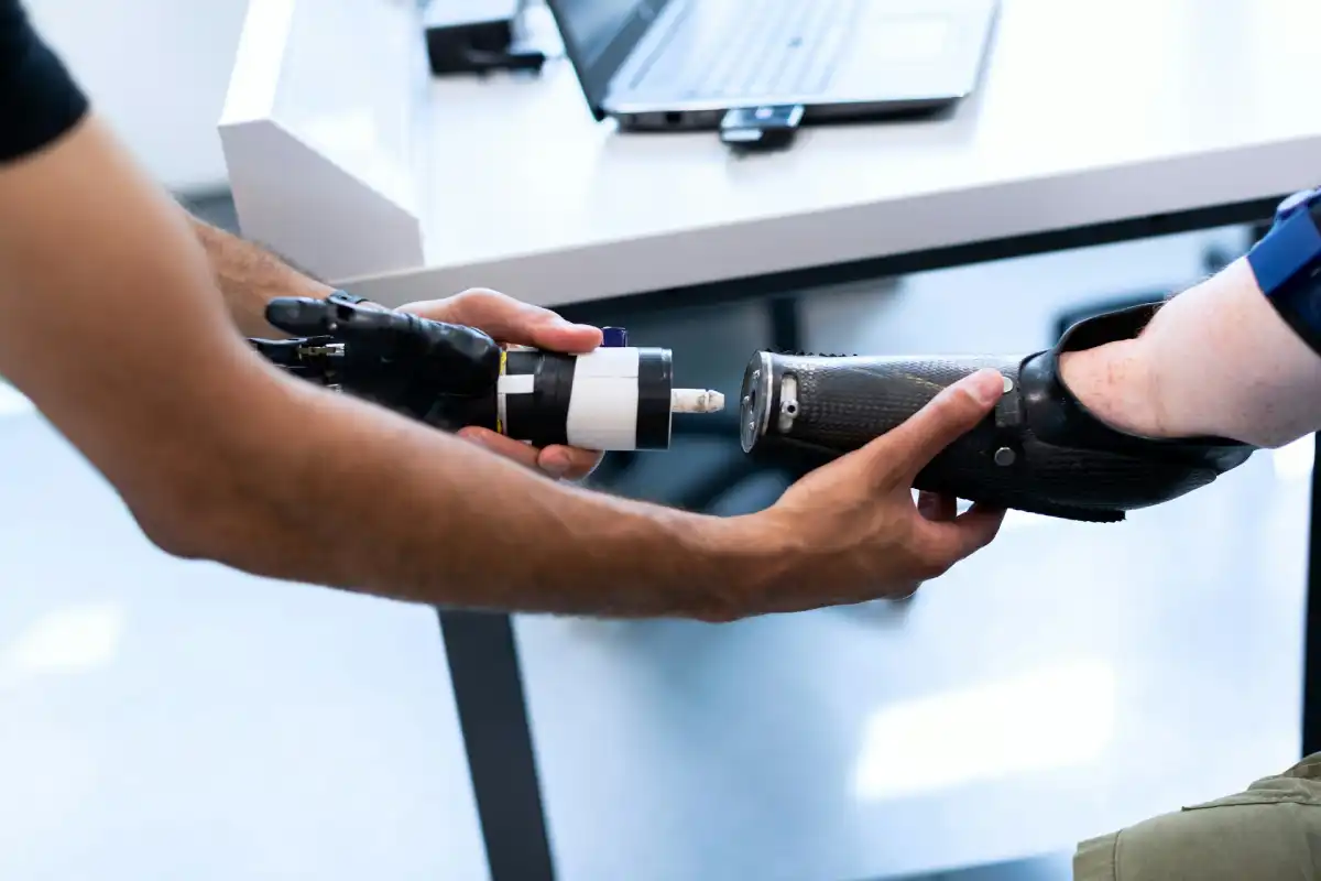 Proesis How Prosthesis Works: The Mechanics Of Artificial Limbs